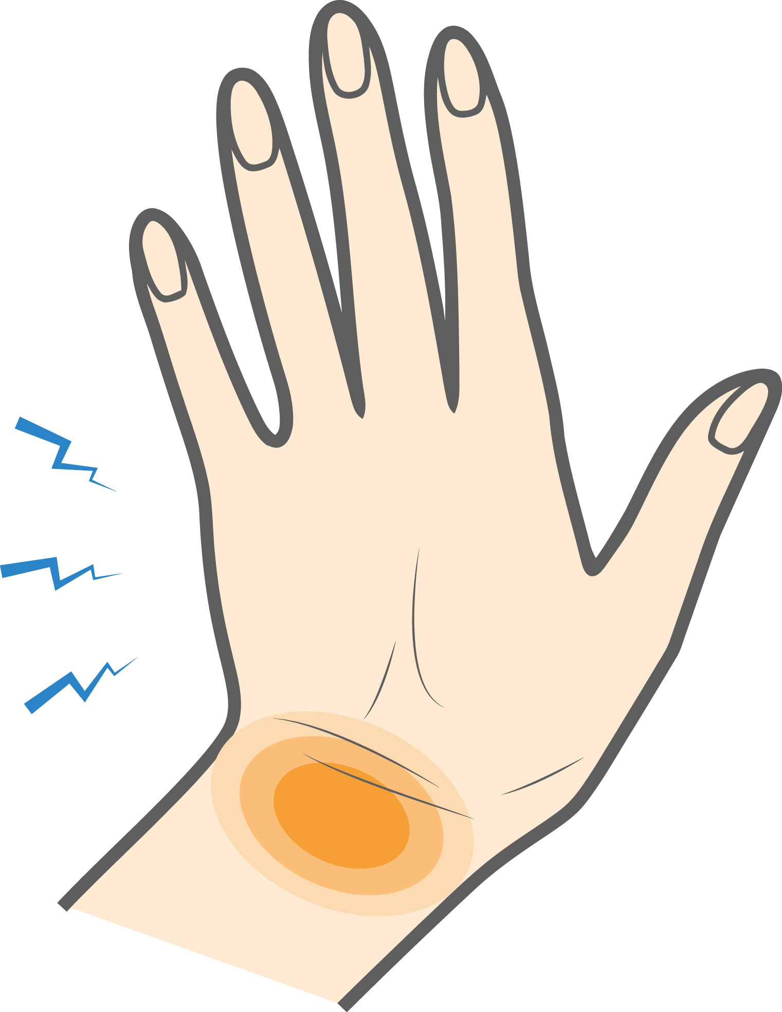 Wrist Pain: Causes, Symptoms, Treatments, and Diagnosis