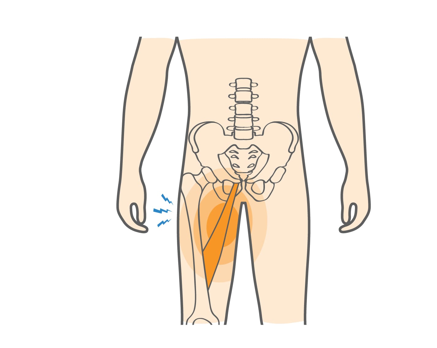Female groin area medical diagram of female groin area anatomy. 