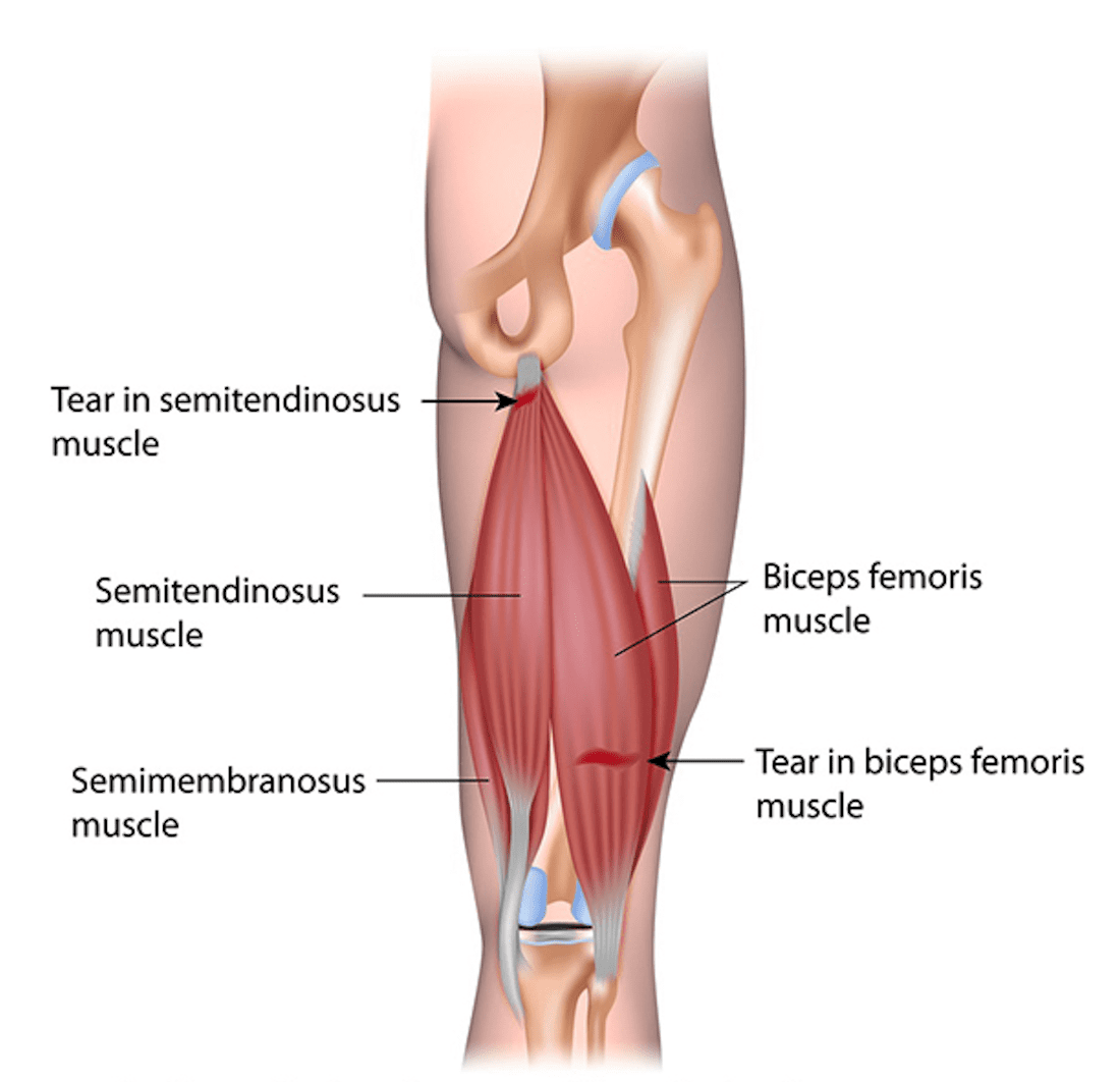 Semitendinosus semimembranosus анатомия