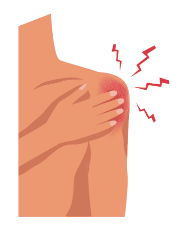 Shoulder Contusion Hero Image 2