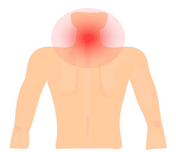 Cervical Strain Injuries Hero Image 2