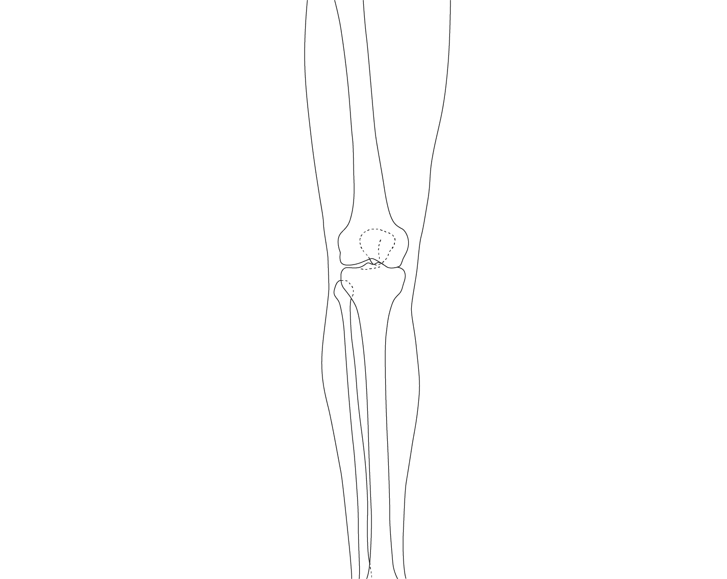 knee-lower-leg-1 background lines