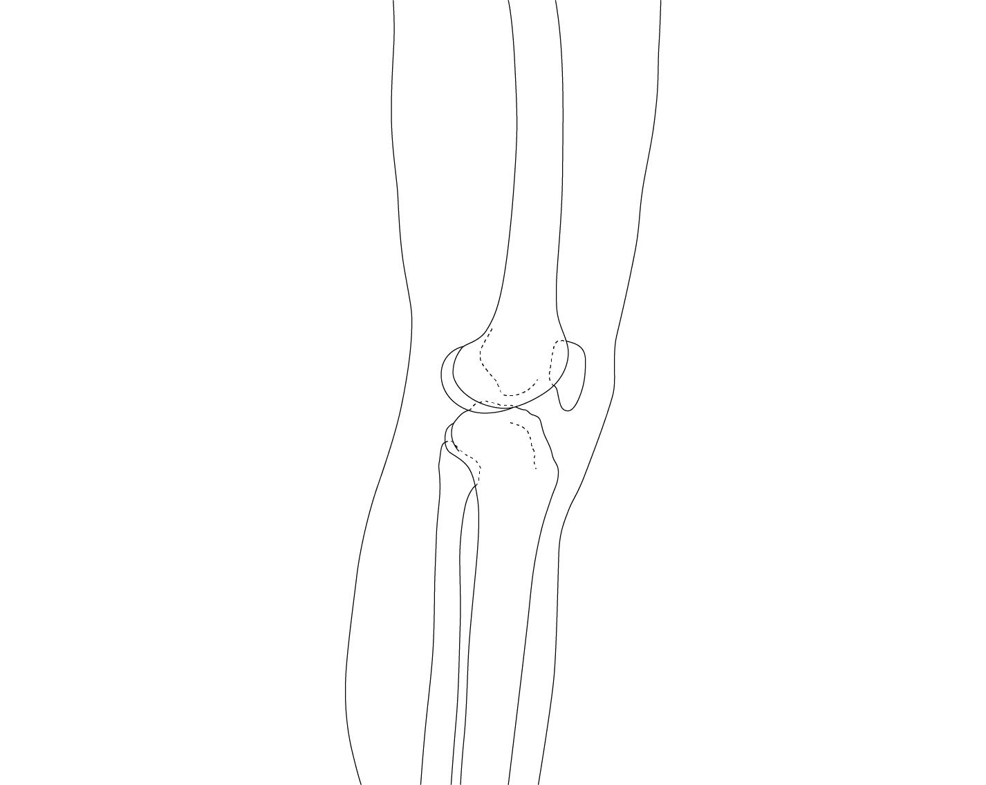 knee-lower-leg-2 background lines
