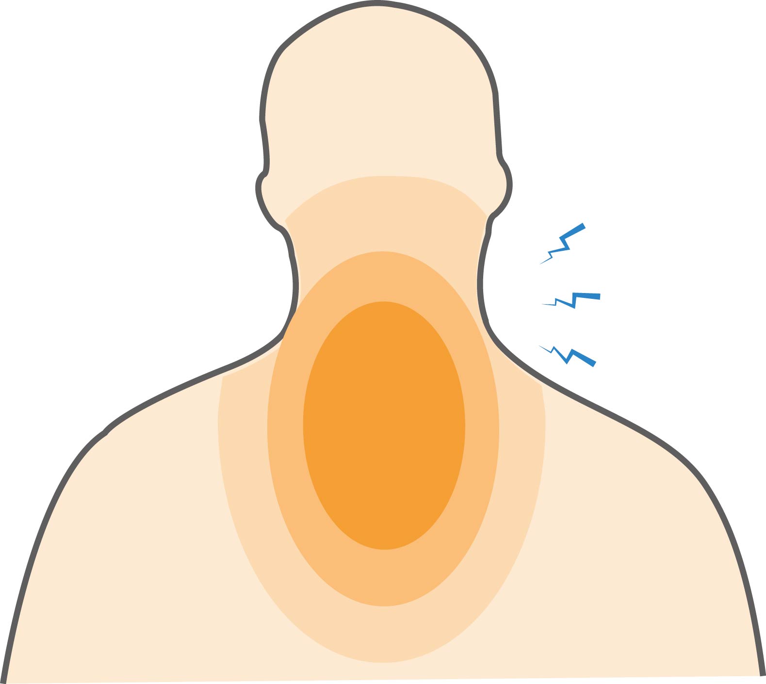 Myofascial Neck/Shoulder Pain Hero Image 2