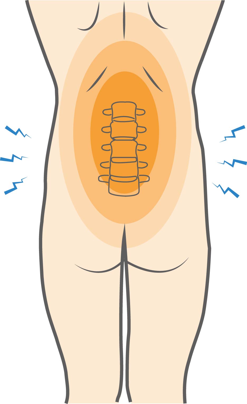 Mechanical or Postural Low Back Pain Hero Image 2