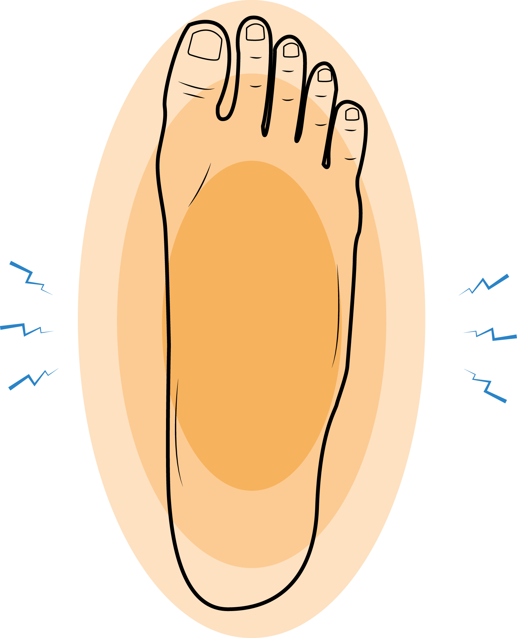 Foot Contusion - Upswing Health | Upswing Health