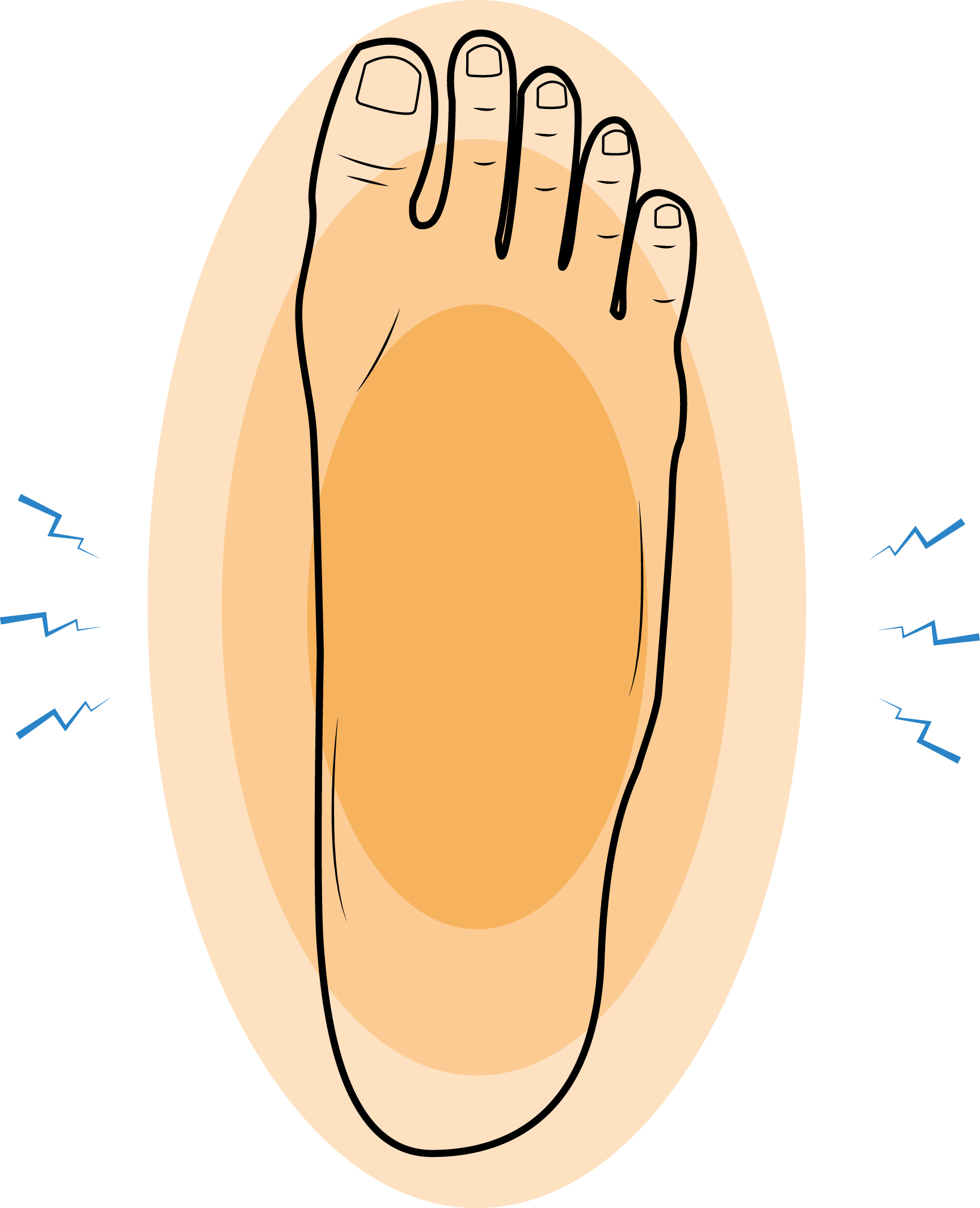 What is a Foot Contusion How to Ease the Pain Upswing Health